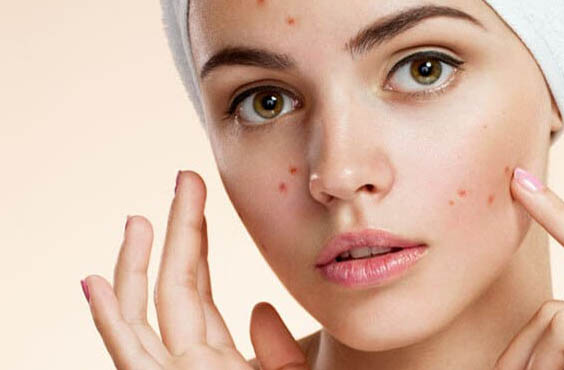 best-acne-&-acne-scar-treatment-in-lucknow