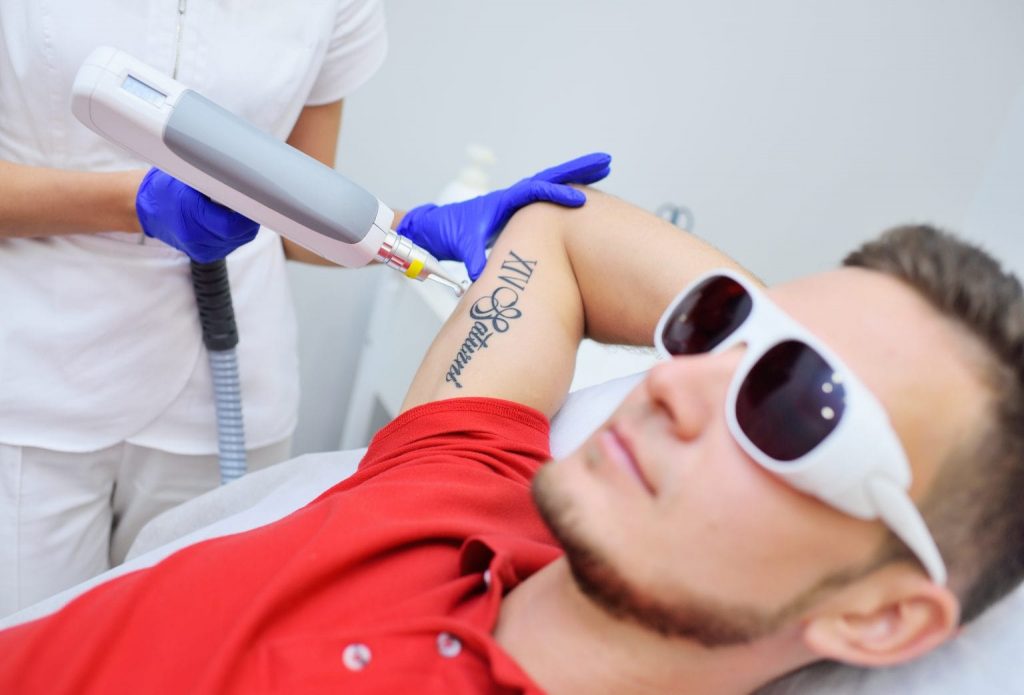 best-tattoo-removal-in-lucknow